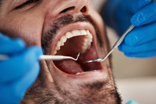Emergency Dental Services in Riverdale, NJ